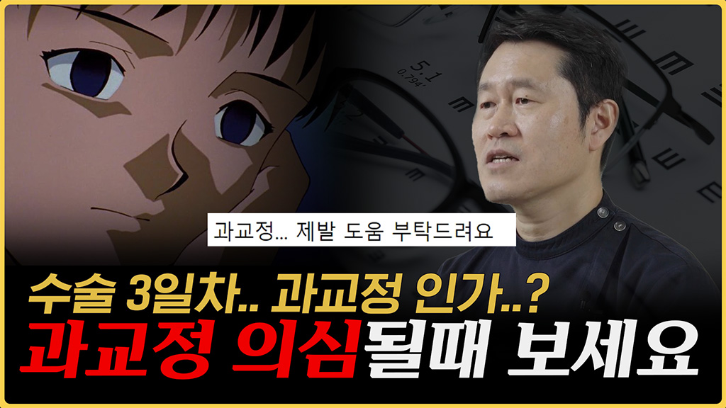 시력교정 후 과교정, 꼭 알아야 할 핵심 포인트