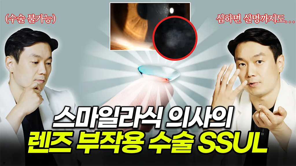 렌즈 7년차, 스마일라식이 안 될 수도 있다? [김성민의 케이쓰터디 Ep.1 스마일라식편] | 눈에미소안과