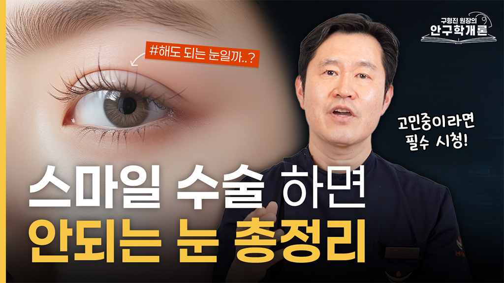 스마일라식 이런 분들은 절대 받으시면 안 됩니다